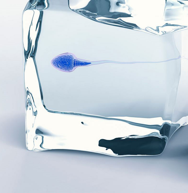 sperm freeze