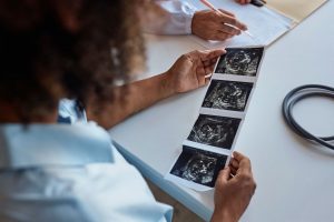 Doctor reviews ultrasound images of developing pregnancy, confirming healthy progress after IVF treatment with expert care.