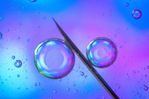 Microscopic view of IVF egg injection, illustrating precise technique used in immunological fertility treatment.