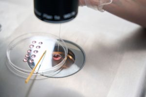 Τεχνικός εργαστηρίου επεξεργάζεται δείγμα σπέρματος κάτω από μικροσκόπιο κατά τη διαδικασία κατάψυξης εξωσωματικής σε αποστειρωμένο κλινικό περιβάλλον.