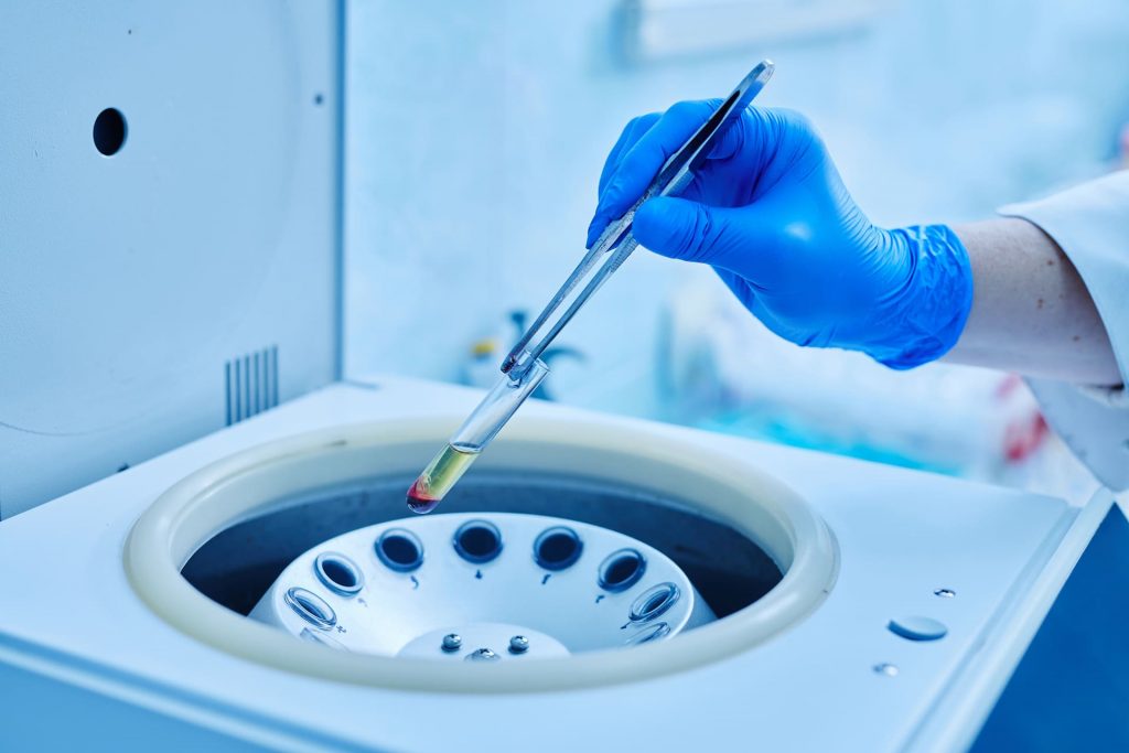 Labortechniker handhabt Probenglas während IVF, konzentriert auf präzise medizinische Vorbereitung.