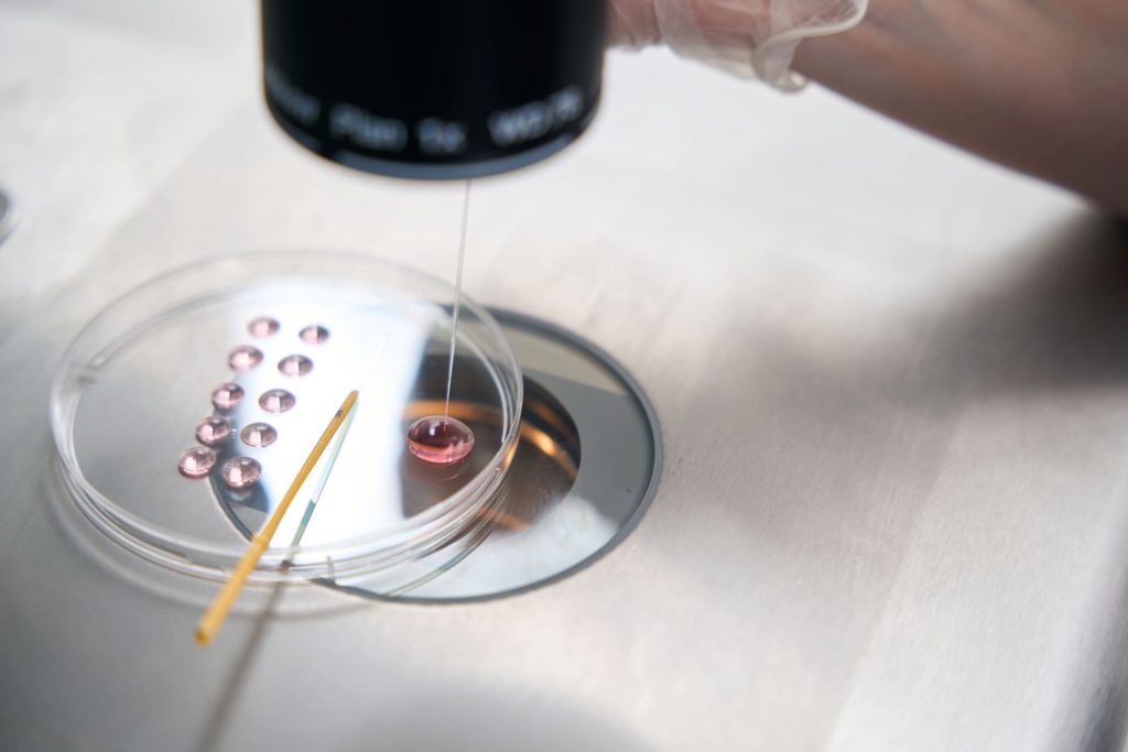 Lab technician processes sperm sample under microscope during IVF freezing procedure in sterile clinical setting.