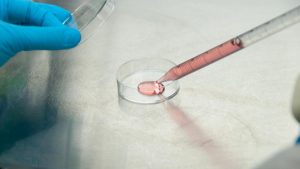 Lab technician performing MACS IVF sperm selection with precision, handling samples carefully to ensure healthy DNA for successful fertilization.