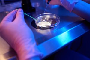 Lab technician performs Zymot sperm sorting in Greece to enhance IVF success through healthier sperm selection.